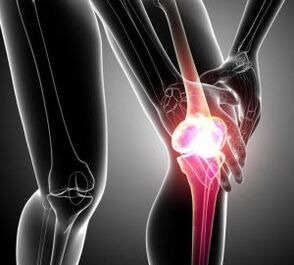 Knee pain in arthritis and rheumatism