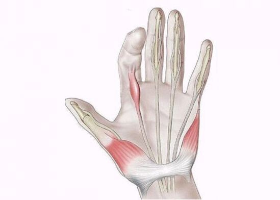 Tendonitis is the cause of pain in the finger joints
