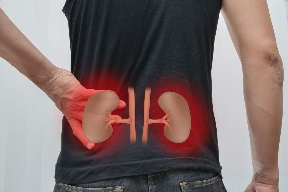 Nephritis is the cause of back pain