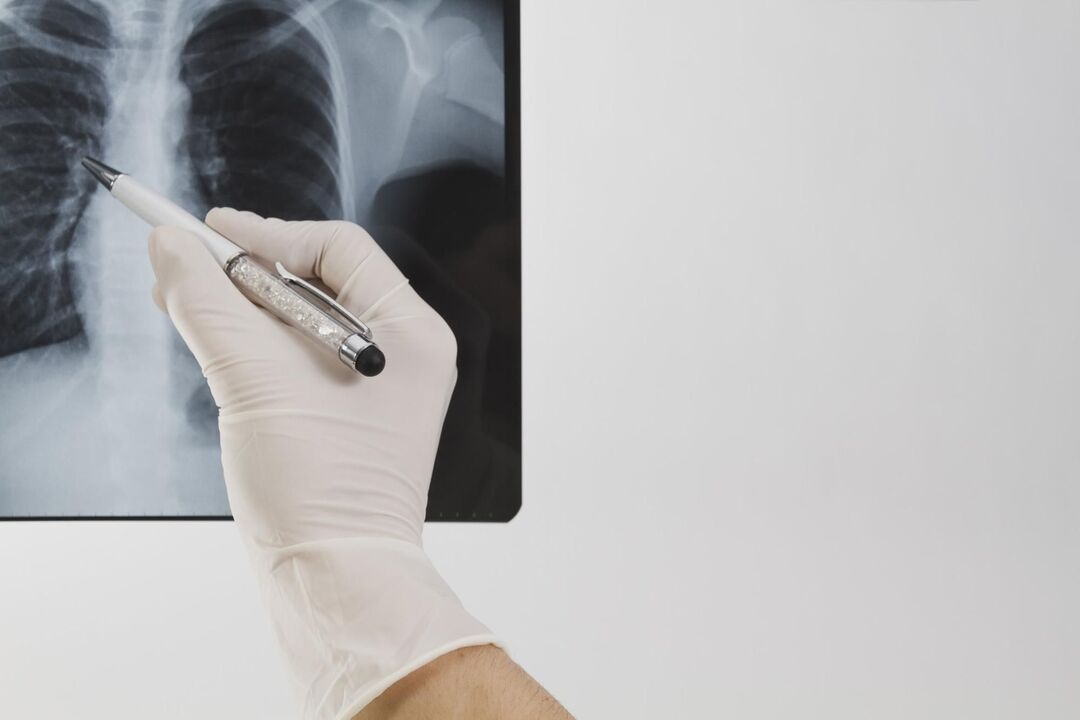 X-rays to diagnose osteoarthritis