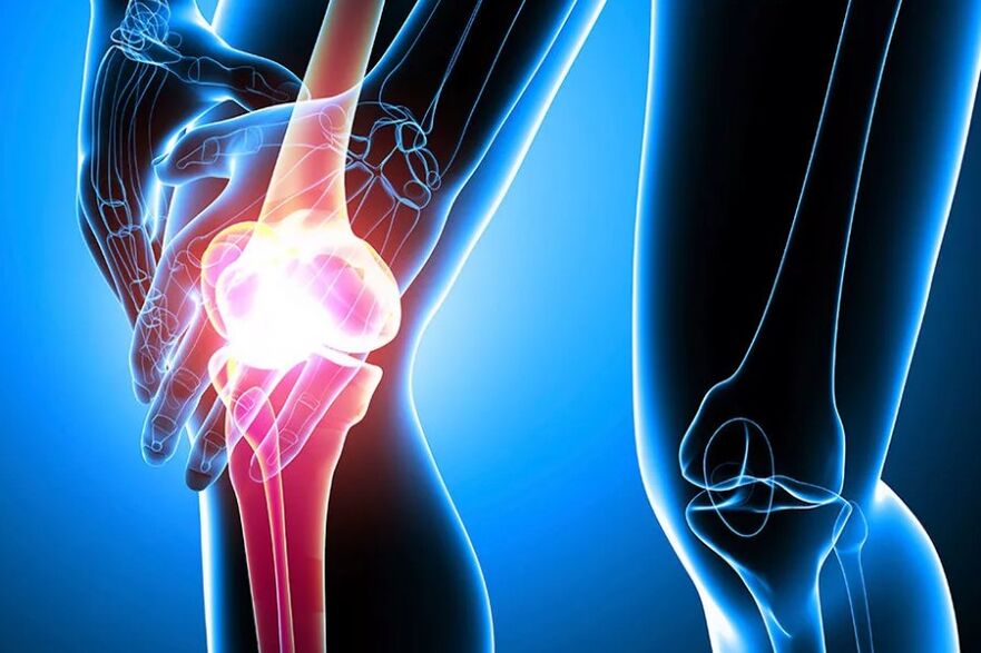 Knee joint pain