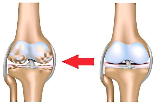 Healthy joints and joints
