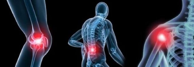 Pains for arthritis