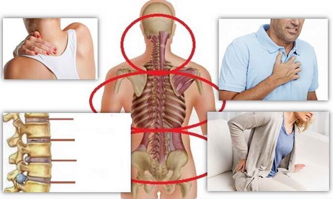 Places with osteoarthritis