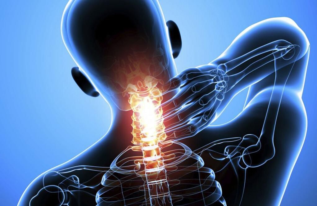 Cervical spine degeneration