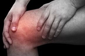 Knee pain due to arthritis
