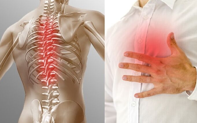 Osteoarthritis of the chest is manifested by pain and tightness in the chest