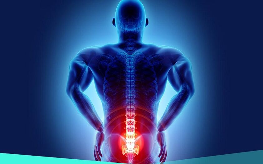 pain due to hip arthritis